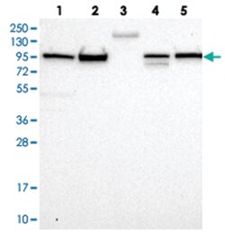 FCHSD2, Rabbit, Polyclonal Antibody, Abnova 100 &mu;L | Buy Online | Abnova | Fisher Scientific