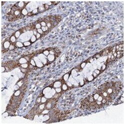 C2CD3, Rabbit, Polyclonal Antibody, Abnova 100 &mu;L | Buy Online | Abnova Corporation | Fisher Scientific