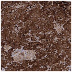 ALG9, Rabbit, Polyclonal Antibody, Abnova 100 &mu;L | Buy Online | Abnova Corporation | Fisher Scientific
