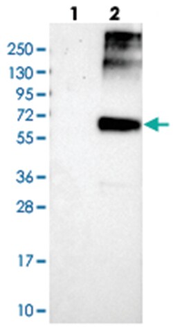 ALG9, Rabbit, Polyclonal Antibody, Abnova 100 &mu;L | Buy Online | Abnova Corporation | Fisher Scientific