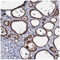ACTR6 Rabbit anti-Human, Polyclonal Antibody, Abnova 100 &mu;L | Buy Online | Abnova Corporation | Fisher Scientific