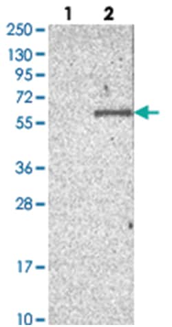 ACTR6 Rabbit anti-Human, Polyclonal Antibody, Abnova 100 &mu;L | Buy Online | Abnova Corporation | Fisher Scientific