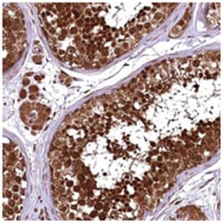 TBCEL, Rabbit, Polyclonal Antibody, Abnova 100&mu;L; Unlabeled:Anticuerpos