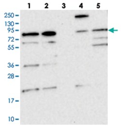 KIAA1731, Rabbit, Polyclonal Antibody, Abnova 100&mu;L; Unlabeled:Antibodies,