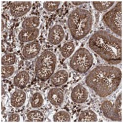 PLEKHA7, Rabbit, Polyclonal Antibody, Abnova 100 &mu;L | Buy Online | Abnova Corporation | Fisher Scientific