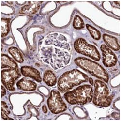 ZNF45, Rabbit, Polyclonal Antibody, Abnova 100 &mu;L | Buy Online | Abnova Corporation | Fisher Scientific