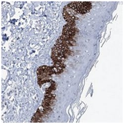 CXorf56 Rabbit anti-Human, Polyclonal Antibody, Abnova 100 &mu;L | Buy Online | Abnova Corporation | Fisher Scientific