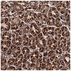 IKIP, Rabbit, Polyclonal Antibody, Abnova 100&mu;L; Unlabeled:Antibodies,