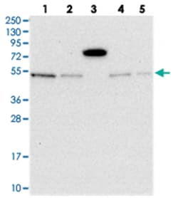 MSANTD2, Rabbit, Polyclonal Antibody, Abnova 100 &mu;L | Buy Online | Abnova Corporation | Fisher Scientific