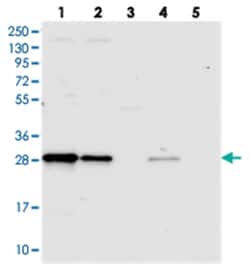 TRPT1, Rabbit, Polyclonal Antibody, Abnova 100&mu;L; Unlabeled:Antibodies,