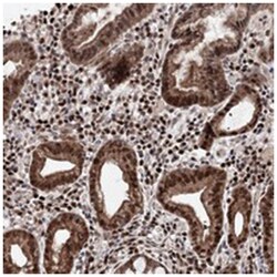 C12orf45, Rabbit, Polyclonal Antibody, Abnova 100 &mu;L | Buy Online | Abnova Corporation | Fisher Scientific