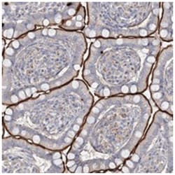 ALKBH8, Rabbit, Polyclonal Antibody, Abnova 100&mu;L; Unlabeled:Antibodies,