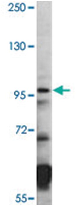 HDAC7 Rabbit anti-Human, Polyclonal Antibody, Abnova 400 &mu;L | Buy Online | Abnova Corporation | Fisher Scientific