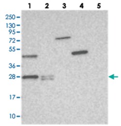 THYN1, Rabbit, Polyclonal Antibody, Abnova 100 &mu;L | Buy Online | Abnova Corporation | Fisher Scientific
