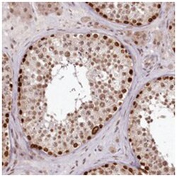 THYN1, Rabbit, Polyclonal Antibody, Abnova 100 &mu;L | Buy Online | Abnova Corporation | Fisher Scientific