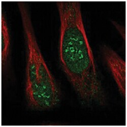 THYN1, Rabbit, Polyclonal Antibody, Abnova 100 &mu;L | Buy Online | Abnova Corporation | Fisher Scientific