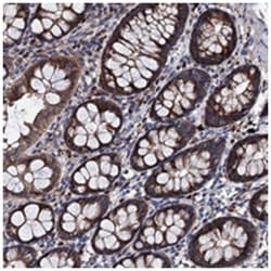 EYA4 Rabbit anti-Human, Polyclonal Antibody, Abnova 100 &mu;L | Buy Online | Abnova Corporation | Fisher Scientific