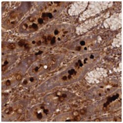 LRRC38, Rabbit, Polyclonal Antibody, Abnova 100 &mu;L | Buy Online | Abnova Corporation | Fisher Scientific