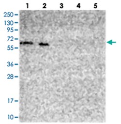 PHF8 Rabbit anti-Human, Polyclonal Antibody, Abnova 100 &mu;L | Buy Online | Abnova Corporation | Fisher Scientific