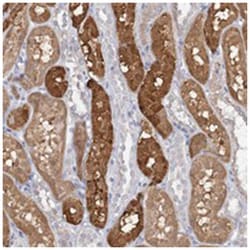 PNISR, Rabbit, Polyclonal Antibody, Abnova 100&mu;L; Unlabeled:Antibodies,
