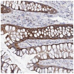 ARHGAP44, Rabbit, Polyclonal Antibody, Abnova 100&mu;L; Unlabeled:Antibodies,