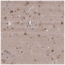 CCDC77, Rabbit, Polyclonal Antibody, Abnova 100&mu;L; Unlabeled:Antibodies,