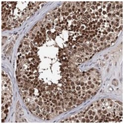 GTSF1, Rabbit, Polyclonal Antibody, Abnova 100 &mu;L | Buy Online | Abnova Corporation | Fisher Scientific