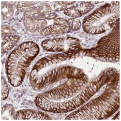 HDC Rabbit anti-Human, Polyclonal Antibody, Abnova 100&mu;L; Unlabeled:Antibodies,