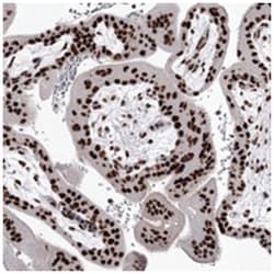 PSPC1, Rabbit, Polyclonal Antibody, Abnova 100&mu;L; Unlabeled:Antibodies,