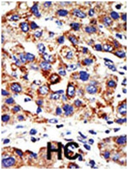 HDAC8 Rabbit anti-Human, Polyclonal Antibody, Abnova 400 &mu;L | Buy Online | Abnova Corporation | Fisher Scientific