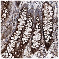 FAM48A Rabbit anti-Human, Polyclonal Antibody, Abnova 100&mu;L; Unlabeled:Antibodies,