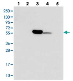 C11orf80, Rabbit, Polyclonal Antibody, Abnova 100&mu;L; Unlabeled:Antibodies,