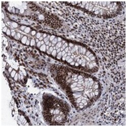 ZCCHC10, Rabbit, Polyclonal Antibody, Abnova 100&mu;L; Unlabeled:Antibodies,