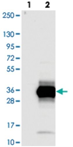ZCCHC10, Rabbit, Polyclonal Antibody, Abnova 100&mu;L; Unlabeled:Antibodies,