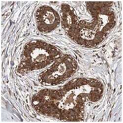MBD6, Rabbit, Polyclonal Antibody, Abnova 100 &mu;L | Buy Online | Abnova Corporation | Fisher Scientific