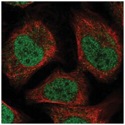 MBD6, Rabbit, Polyclonal Antibody, Abnova 100 &mu;L | Buy Online | Abnova Corporation | Fisher Scientific