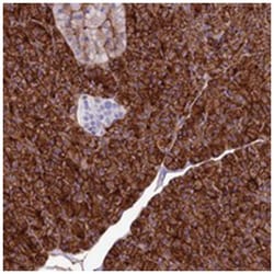 ANO6, Rabbit, Polyclonal Antibody, Abnova 100&mu;L; Unlabeled:Antibodies,