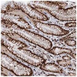 WBP4, Rabbit, Polyclonal Antibody, Abnova 100 &mu;L | Buy Online | Abnova Corporation | Fisher Scientific
