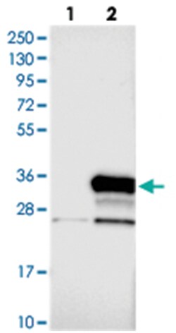 N4BP2L1, Rabbit, Polyclonal Antibody, Abnova 100&mu;L; Unlabeled:Antibodies,