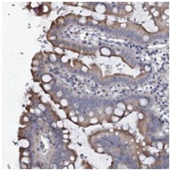 PRHOXNB, Rabbit, Polyclonal Antibody, Abnova 100 &mu;L | Buy Online | Abnova | Fisher Scientific