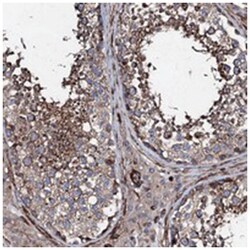BRWD2 Rabbit anti-Human, Polyclonal Antibody, Abnova 100 &mu;L | Buy Online | Abnova Corporation | Fisher Scientific