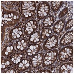 SAAL1, Rabbit, Polyclonal Antibody, Abnova 100&mu;L; Unlabeled:Antibodies,
