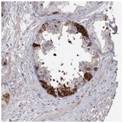 FDXACB1, Rabbit, Polyclonal Antibody, Abnova 100&mu;L; Unlabeled:Antibodies,