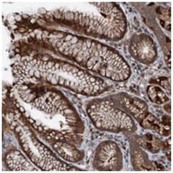 C14orf80, Rabbit, Polyclonal Antibody, Abnova 100&mu;L; Unlabeled:Antibodies,
