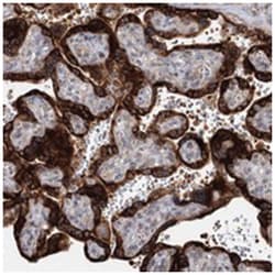 SPG20, Rabbit, Polyclonal Antibody, Abnova 100&mu;L; Unlabeled:Antibodies,