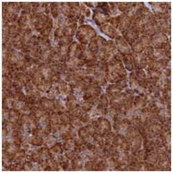 DNAH10, Rabbit, Polyclonal Antibody, Abnova 100 &mu;L | Buy Online | Abnova Corporation | Fisher Scientific