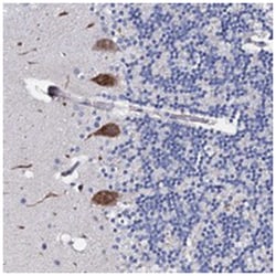 PPP1R32, Rabbit, Polyclonal Antibody, Abnova 100 &mu;L | Buy Online | Abnova Corporation | Fisher Scientific