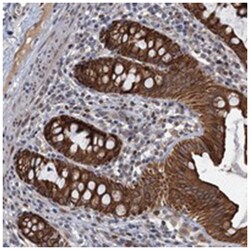 C12orf52, Rabbit, Polyclonal Antibody, Abnova 100&mu;L; Unlabeled:Antibodies,
