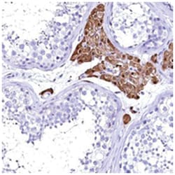 KCNG4, Rabbit, Polyclonal Antibody, Abnova 100 &mu;L | Buy Online | Abnova Corporation | Fisher Scientific