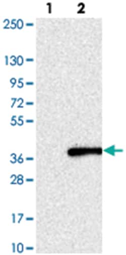 KCNG4, Rabbit, Polyclonal Antibody, Abnova 100 &mu;L | Buy Online | Abnova Corporation | Fisher Scientific